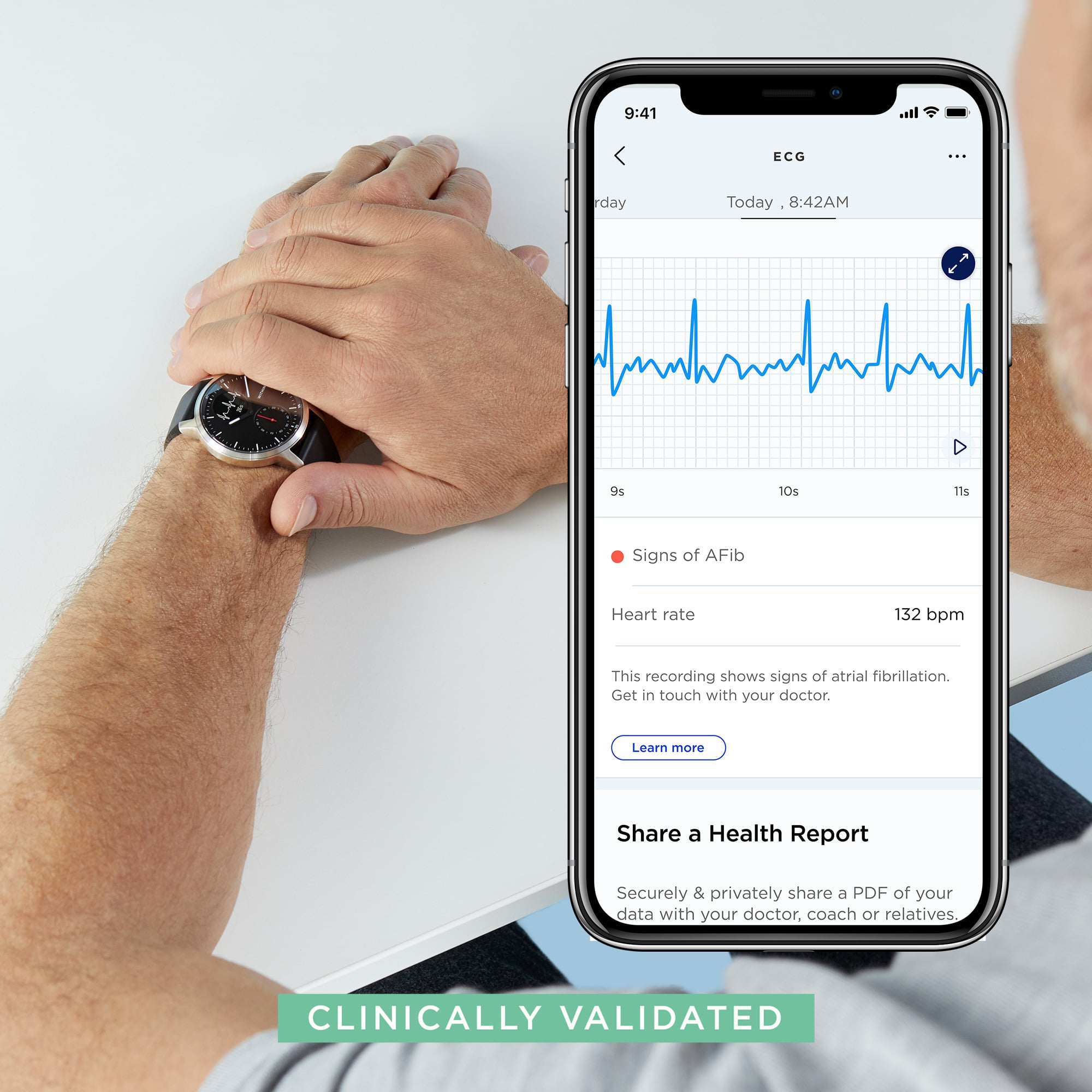 tuotteen-withings-scanwatch-ekg-aktiivisuuskello-valkoinen-38mm